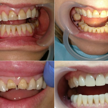 Лікорис, Вінниця Фото - 8