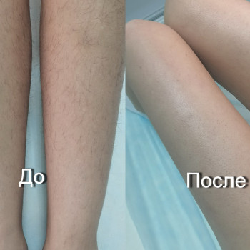 Женские ножки