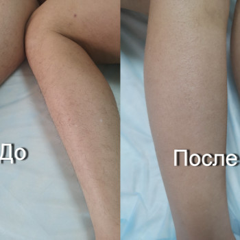 Татьяна Сторч, Николаев Фото - 9