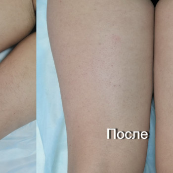 Татьяна Сторч, Николаев Фото - 10