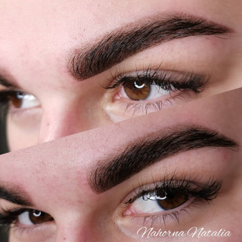 Фото сразу после процедуры