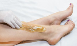 Ваксинг (удаление волос с помощью воска) Майстер депіляції Татьяна Миколаїв