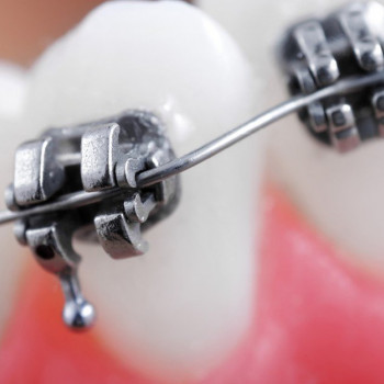 Омега Дент, Житомир Фото - 5