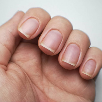 Юлия Носач, Вишневе Фото - 21