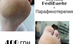 Smart педикюр + Парафинотерапия Майстер манікюру Юлия Вишневе