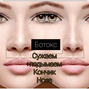 Уменьшение носика липолитиком
                    Косметолог Ксения Кропивницкий