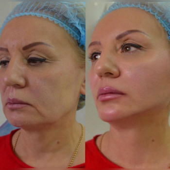 Ксенія Дідур, Кропивницький Фото - 2