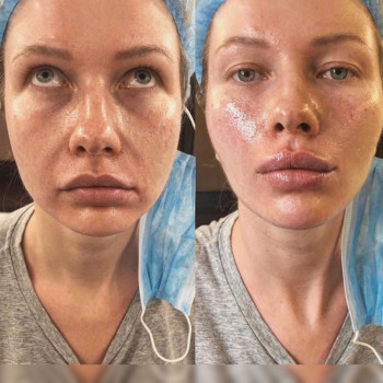 Ксенія Дідур, Кропивницький Фото - 5