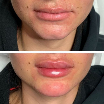 Ксенія Дідур, Кропивницький Фото - 8