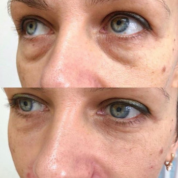 Ксенія Дідур, Кропивницький Фото - 9