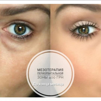 Ксенія Дідур, Кропивницький Фото - 10