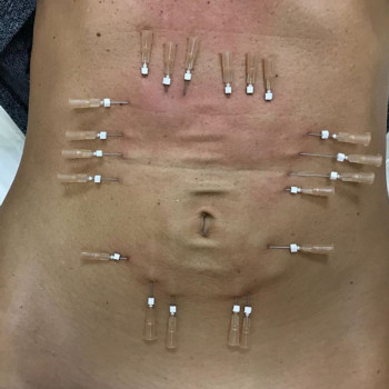 Ксенія Дідур, Кропивницький Фото - 13