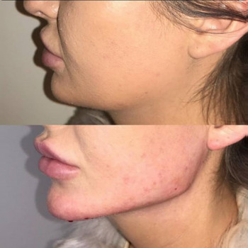 Ксенія Дідур, Кропивницький Фото - 22