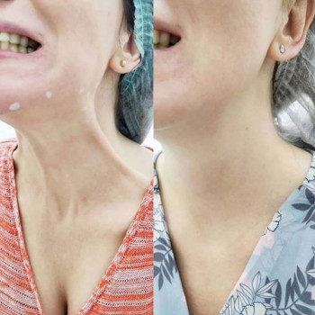 Ксенія Дідур, Кропивницький Фото - 23