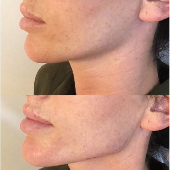 Ксенія Дідур, Кропивницький Фото - 25