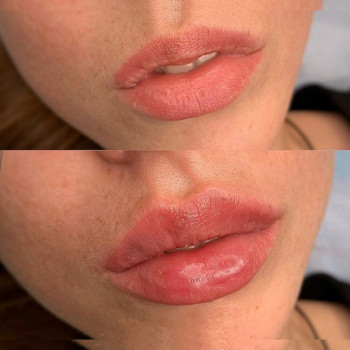 Ксенія Дідур, Кропивницький Фото - 28