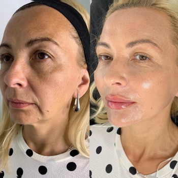 Ксенія Дідур, Кропивницький Фото - 29