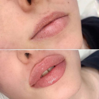 Ксенія Дідур, Кропивницький Фото - 32