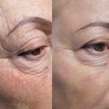 Ксенія Дідур, Кропивницький Фото - 33