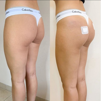 Ксенія Дідур, Кропивницький Фото - 43