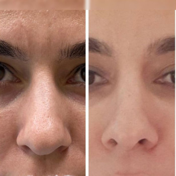 Ксенія Дідур, Кропивницький Фото - 46