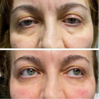 Ксенія Дідур, Кропивницький Фото - 47