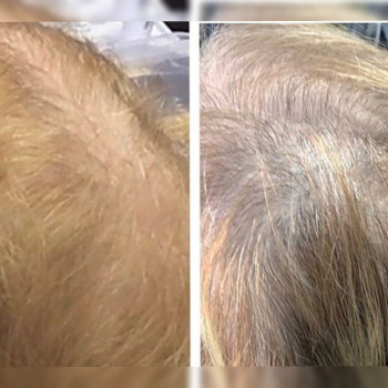 Ксенія Дідур, Кропивницький Фото - 50