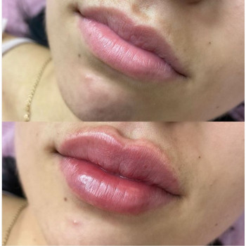 Ксенія Дідур, Кропивницький Фото - 51