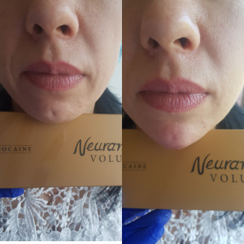 Ксенія Дідур, Кропивницький Фото - 56