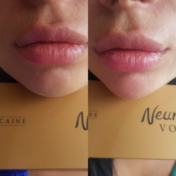 Ксенія Дідур, Кропивницький Фото - 58