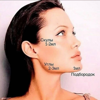 Ксенія Дідур, Кропивницький Фото - 66