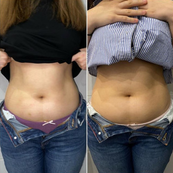 Ксенія Дідур, Кропивницький Фото - 67