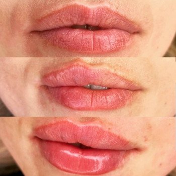 Ксенія Дідур, Кропивницький Фото - 73