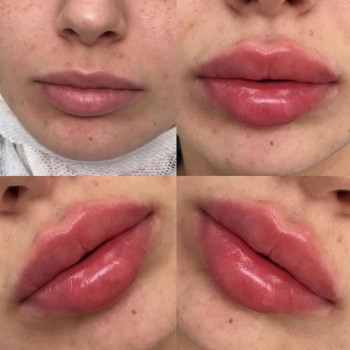 Ксенія Дідур, Кропивницький Фото - 76