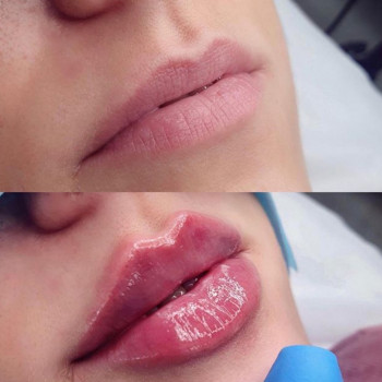 Ксенія Дідур, Кропивницький Фото - 77