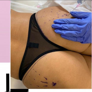 Ксенія Дідур, Кропивницький Фото - 78