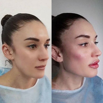 Ксенія Дідур, Кропивницький Фото - 83