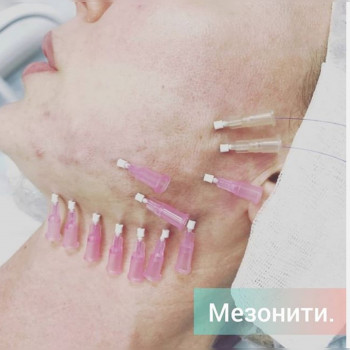 Ксенія Дідур, Кропивницький Фото - 84