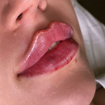 Ксенія Дідур, Кропивницький Фото - 89