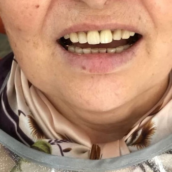 Дентал Еліт, Запорожье Фото - 5