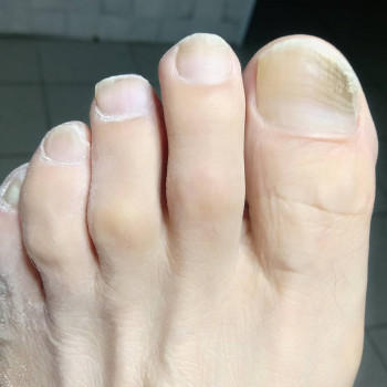 Катерина Діряба, Запоріжжя Фото - 35