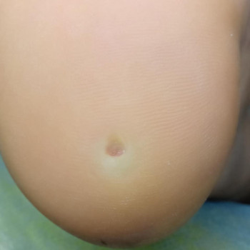 Катерина Діряба, Запоріжжя Фото - 38