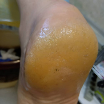 Катерина Діряба, Запоріжжя Фото - 40