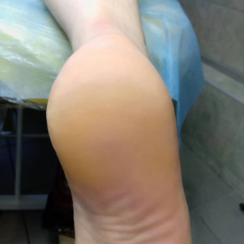 Катерина Діряба, Запоріжжя Фото - 41