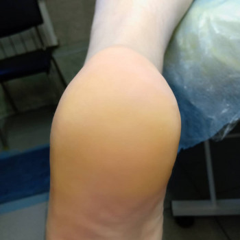 Катерина Діряба, Запоріжжя Фото - 16