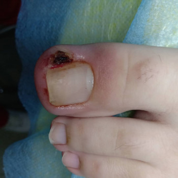 Катерина Діряба, Запоріжжя Фото - 11