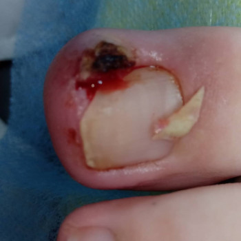 Катерина Діряба, Запоріжжя Фото - 12