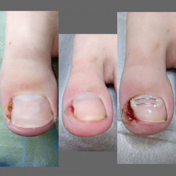 Катерина Діряба, Запоріжжя Фото - 13