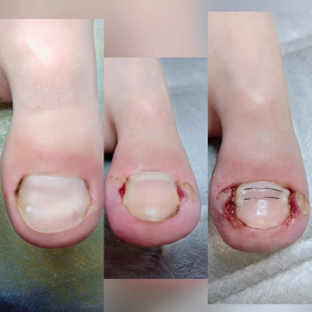 Катерина Діряба, Запоріжжя Фото - 14