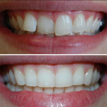 Дантист, Запорожье Фото - 5